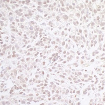 Rabbit CHD8 Antibody