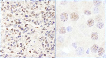 Rabbit CHD3 Antibody