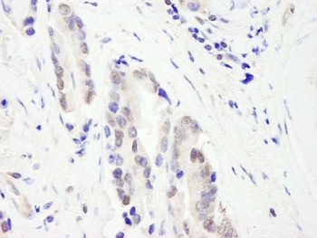 Rabbit CHD3 Antibody