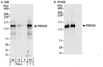 Rabbit RBM26 Antibody