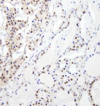 Rabbit RBM26 Antibody