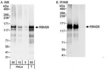 Rabbit RBM26 Antibody