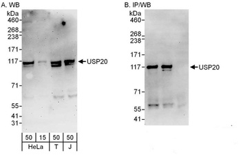 Rabbit USP20/VDU2 Antibody