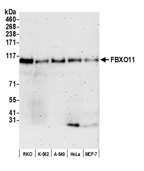 Rabbit FBXO11 Antibody