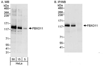 Rabbit FBXO11 Antibody
