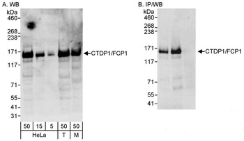Rabbit CTDP1/FCP1 Antibody