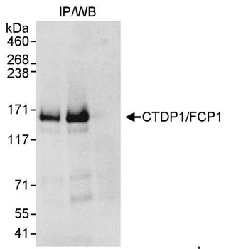Rabbit CTDP1/FCP1 Antibody
