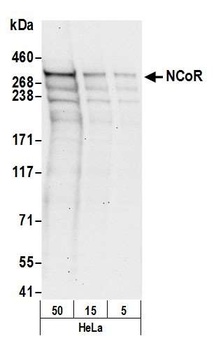 Rabbit NCoR Antibody