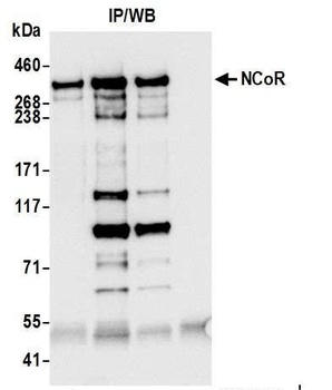 Rabbit NCoR Antibody