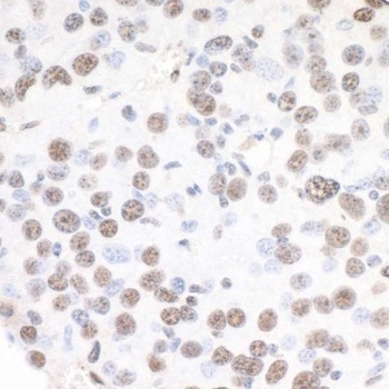 Rabbit XRN2 Antibody