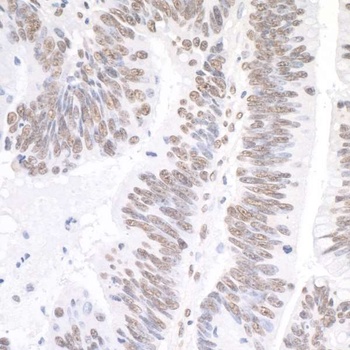 Rabbit XRN2 Antibody