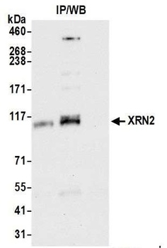 Rabbit XRN2 Antibody