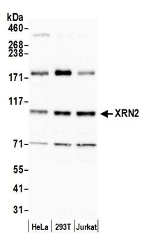 Rabbit XRN2 Antibody