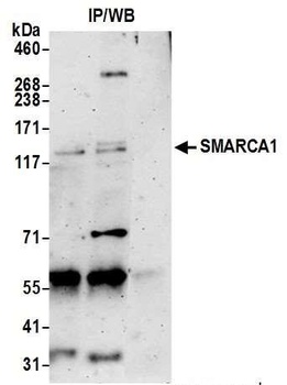 Rabbit SMARCA1/SNF2L Antibody