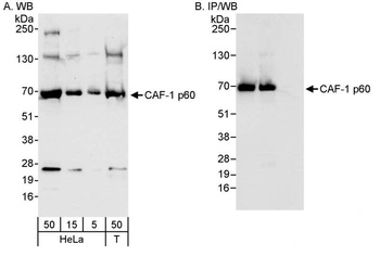 Rabbit CAF-1 p60 Antibody