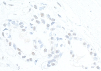 Rabbit anti-ATRX Antibody