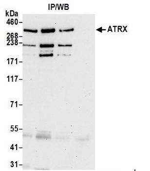 Rabbit anti-ATRX Antibody