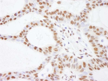 Rabbit SMARCC2/BAF170 Antibody