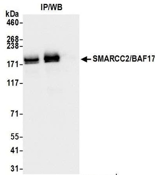 Rabbit SMARCC2/BAF170 Antibody