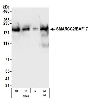 Rabbit SMARCC2/BAF170 Antibody