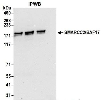 Rabbit SMARCC2/BAF170 Antibody