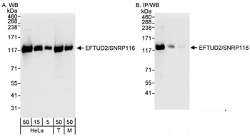 Rabbit EFTUD2/SNRP116 Antibody