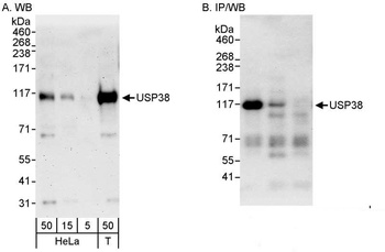 Rabbit USP38 Antibody