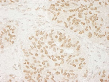 Rabbit USP33 Antibody