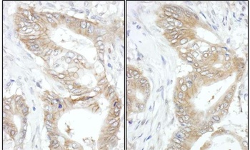 Rabbit USP14 Antibody