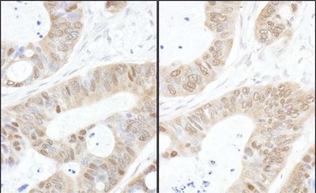 Rabbit USP14 Antibody