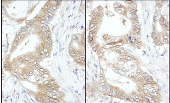 Rabbit USP14 Antibody