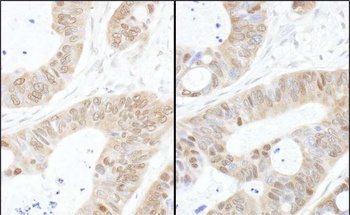 Rabbit USP14 Antibody