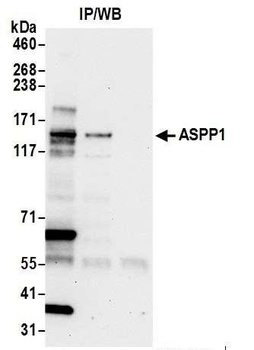 Rabbit ASPP1 Antibody