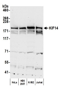 Rabbit KIF14 Antibody