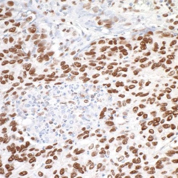 Rabbit MTA1 Antibody
