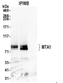 Rabbit MTA1 Antibody