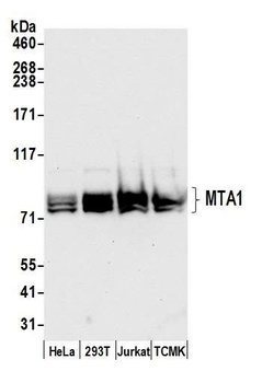 Rabbit MTA1 Antibody