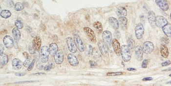Rabbit Sin1 Antibody
