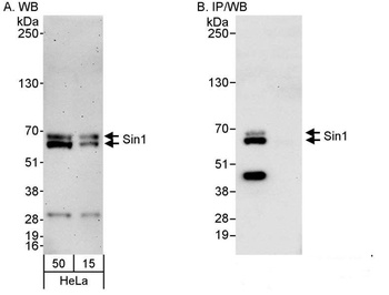 Rabbit Sin1 Antibody