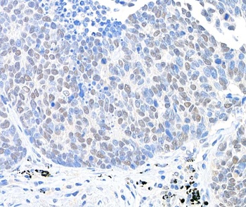 Rabbit USP28 Antibody
