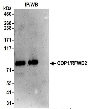 Rabbit COP1/RFWD2 Antibody
