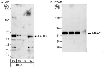 Rabbit P4HA2 Antibody