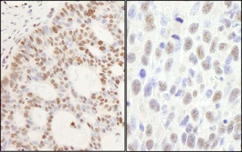 Rabbit PPM1G Antibody