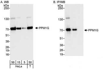 Rabbit PPM1G Antibody
