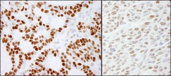 Rabbit RCC2 Antibody