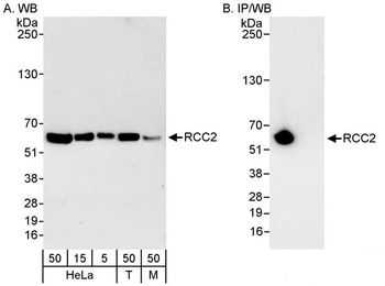 Rabbit RCC2 Antibody