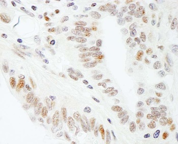 Rabbit SUPT5H Antibody