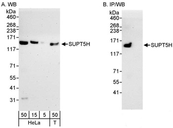 Rabbit SUPT5H Antibody