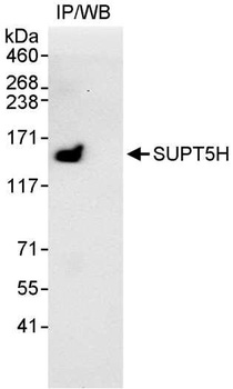 Rabbit SUPT5H Antibody