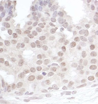 Rabbit Gemin4 Antibody